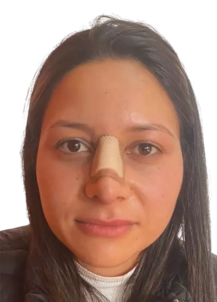 CeaChocontá